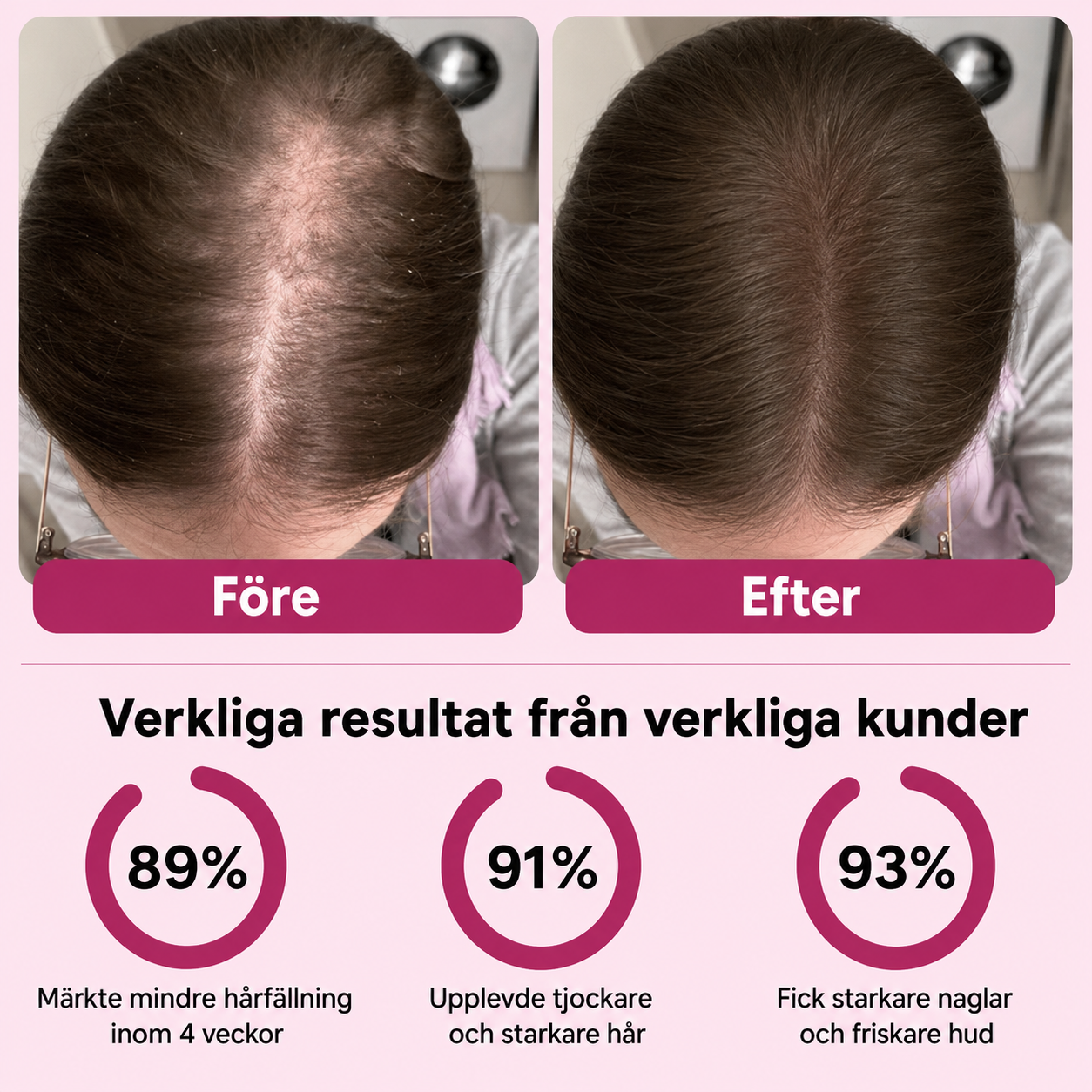 Biotin Gummies – För Längre, Tjockare & Starkare Hår