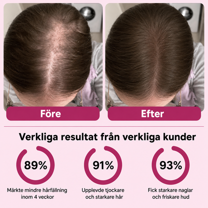 Biotin Gummies – För Längre, Tjockare & Starkare Hår